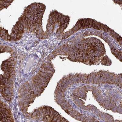 Immunohistochemistry-Paraffin: P4HA2 Antibody (CL0351) [NBP2-52922]