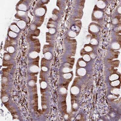 Immunohistochemistry-Paraffin: P4HA2 Antibody (CL0351) [NBP2-52922]