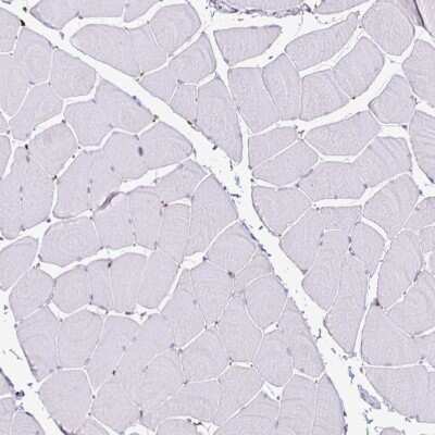 Immunohistochemistry-Paraffin: P4HA2 Antibody (CL0351) [NBP2-52922]