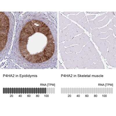 Immunohistochemistry-Paraffin: P4HA2 Antibody (CL0351) [NBP2-52922]