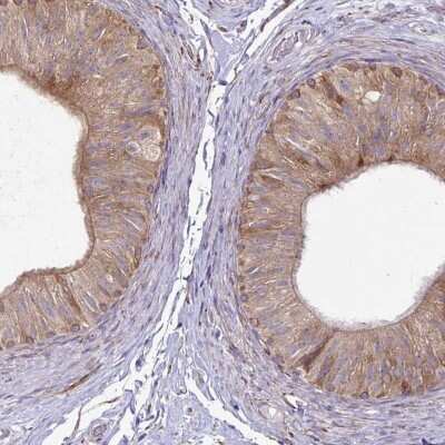 Immunohistochemistry-Paraffin: P4HA2 Antibody [NBP2-33878]