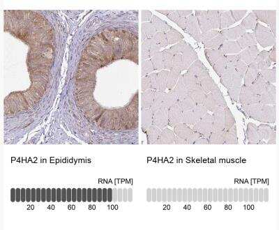 Immunohistochemistry-Paraffin: P4HA2 Antibody [NBP2-33878]