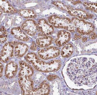 Immunohistochemistry-Paraffin: P4HA2 Antibody [NBP2-33878]