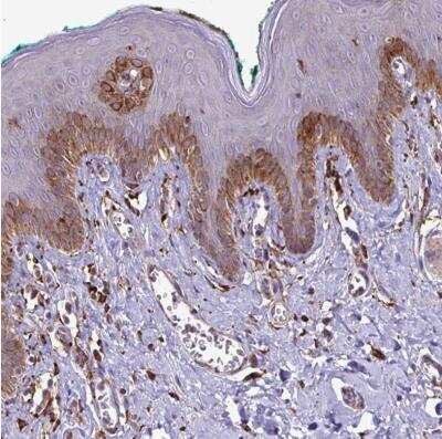 Immunohistochemistry-Paraffin: P4HA2 Antibody [NBP2-33878]