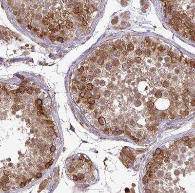 Immunohistochemistry-Paraffin: P4HA2 Antibody [NBP2-33878]