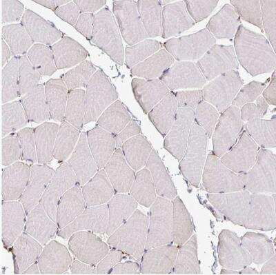 Immunohistochemistry-Paraffin: P4HA2 Antibody [NBP2-33878]
