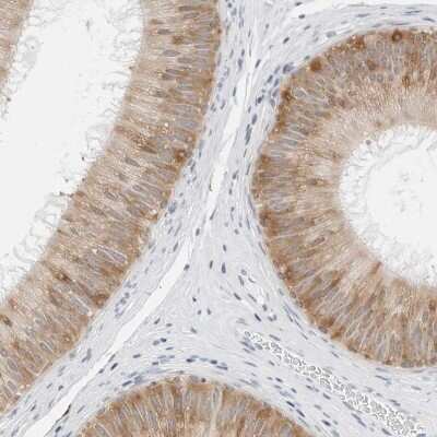 Immunohistochemistry-Paraffin: P4HA2 Antibody [NBP2-33909]