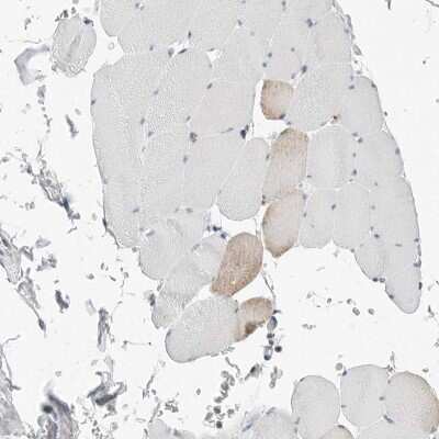 Immunohistochemistry-Paraffin: P4HA2 Antibody [NBP2-33909]