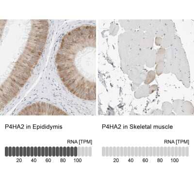 Immunohistochemistry-Paraffin: P4HA2 Antibody [NBP2-33909]