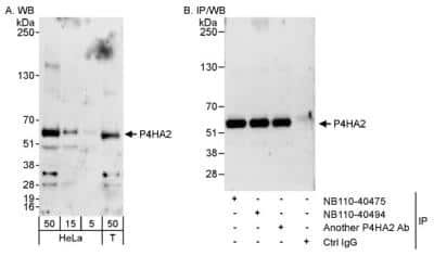 Immunoprecipitation: P4HA2 Antibody [NB110-40494]