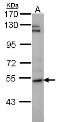 Western Blot: P4HA2 Antibody [NBP2-19665]