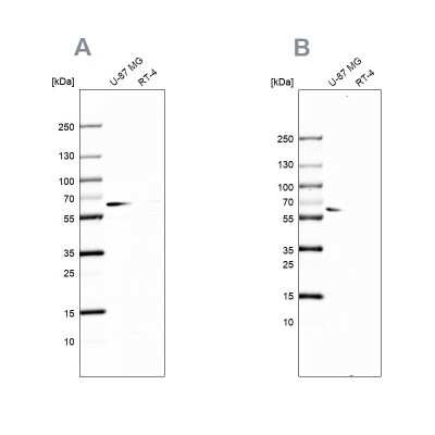 Western Blot: P4HA2 Antibody [NBP2-33909]