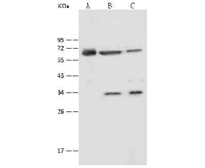 Western Blot: P4HA2 Antibody [NBP2-99486]