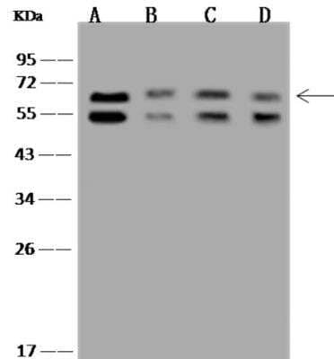 Western Blot: P4HA2 Antibody [NBP3-06468]