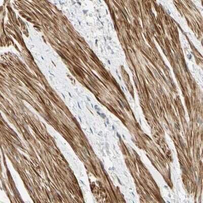 Immunohistochemistry-Paraffin: P4HA3 Antibody [NBP1-84396]