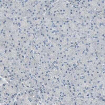 Immunohistochemistry-Paraffin: P4HA3 Antibody [NBP1-84396]
