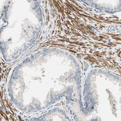 Immunohistochemistry-Paraffin: P4HA3 Antibody [NBP1-84396]