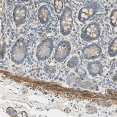 Immunohistochemistry-Paraffin: P4HA3 Antibody [NBP1-84396]
