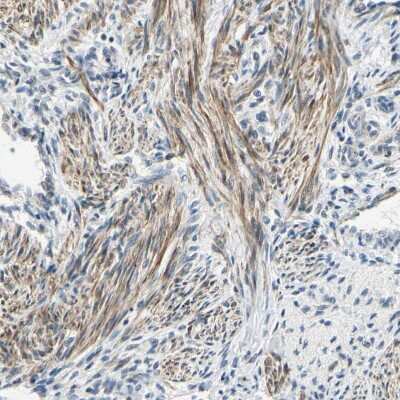 Immunohistochemistry-Paraffin: P4HA3 Antibody [NBP1-84396]