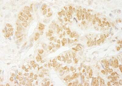 Immunohistochemistry: PA1 Antibody [NBP1-06542]