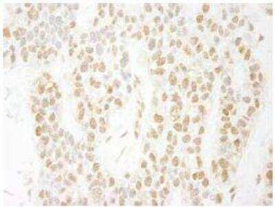 Immunohistochemistry-Paraffin: PA1 Antibody [NBP1-06542]