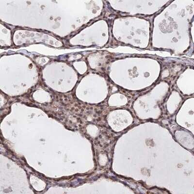 Immunohistochemistry-Paraffin: PA1 Antibody [NBP1-89792]