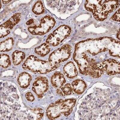 Immunohistochemistry-Paraffin: PA1 Antibody [NBP1-89793]