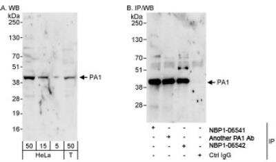 Western Blot: PA1 Antibody [NBP1-06541]