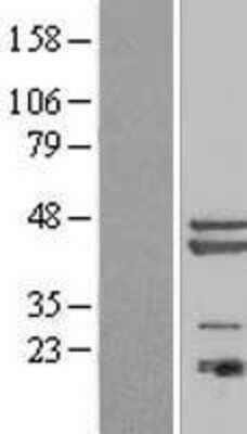 Western Blot: PA1 Overexpression Lysate [NBL1-08216]