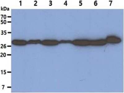 Western Blot: PA28 Activator alpha Subunit/PSME1 Antibody (12H3)BSA Free [NBP2-59434]