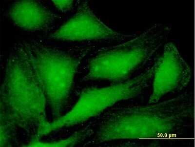 Immunocytochemistry/ Immunofluorescence: PA28 Activator alpha Subunit/PSME1 Antibody [H00005720-B01P]