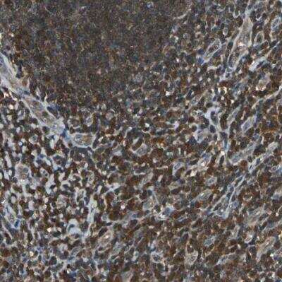Immunohistochemistry-Paraffin: PA28 Activator alpha Subunit/PSME1 Antibody [NBP1-83121]