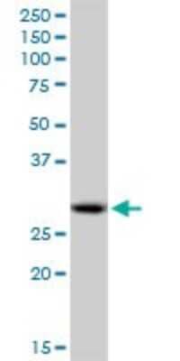 Western Blot: PA28 Activator alpha Subunit/PSME1 Antibody [H00005720-B01P]