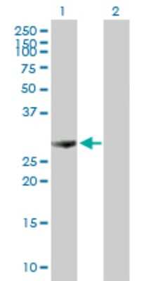 Western Blot: PA28 Activator alpha Subunit/PSME1 Antibody [H00005720-B01P]