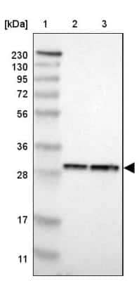 Western Blot: PA28 Activator alpha Subunit/PSME1 Antibody [NBP1-83121]