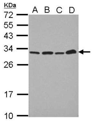 Western Blot: PA28 Activator alpha Subunit/PSME1 Antibody [NBP2-19991]