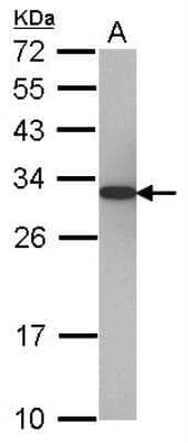 Western Blot: PA28 Activator alpha Subunit/PSME1 Antibody [NBP2-19992]