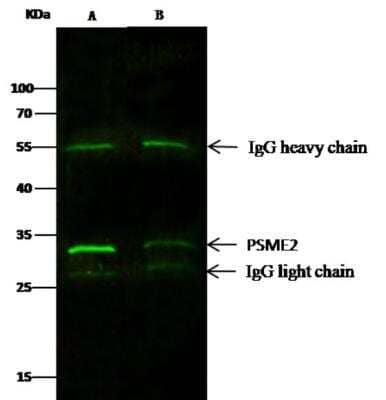 Immunoprecipitation: PA28 Activator beta Subunit/PSME2 Antibody (06) [NBP3-06553]