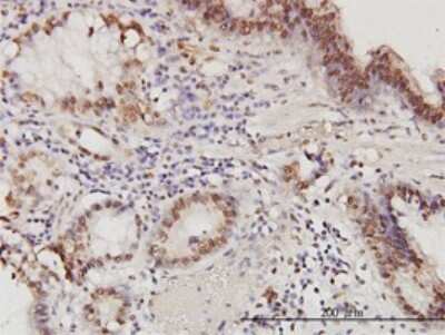 Immunohistochemistry-Paraffin: PA28 Activator beta Subunit/PSME2 Antibody (1G4) [H00005721-M02]