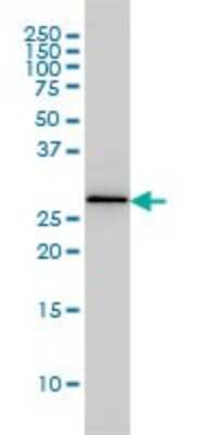 Western Blot: PA28 Activator beta Subunit/PSME2 Antibody (1G4) [H00005721-M02]