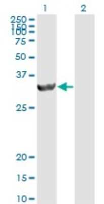 Western Blot: PA28 Activator beta Subunit/PSME2 Antibody (1G4) [H00005721-M02]