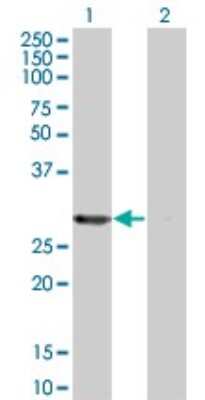 Western Blot: PA28 Activator beta Subunit/PSME2 Antibody (3F11-1A3) [H00005721-M01]