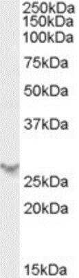 Western Blot: PA28 Activator beta Subunit/PSME2 Antibody [NB100-59752]