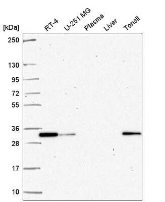 Western Blot: PA28 Activator beta Subunit/PSME2 Antibody [NBP2-57628]