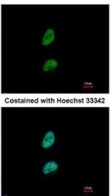 Immunocytochemistry/ Immunofluorescence: PA28 Activator gamma Subunit/PSME3 Antibody [NBP1-33498]