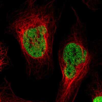 Immunocytochemistry/ Immunofluorescence: PA28 Activator gamma Subunit/PSME3 Antibody [NBP1-83063]