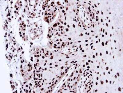 Immunohistochemistry-Paraffin: PA28 Activator gamma Subunit/PSME3 Antibody [NBP1-33498]