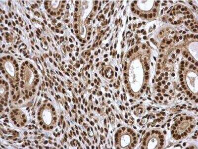 Immunohistochemistry-Paraffin: PA28 Activator gamma Subunit/PSME3 Antibody [NBP1-33498]
