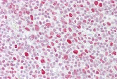 Immunohistochemistry-Paraffin: PA28 Activator gamma Subunit/PSME3 Antibody [NBP1-54587]