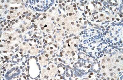 Immunohistochemistry-Paraffin: PA28 Activator gamma Subunit/PSME3 Antibody [NBP1-54587]